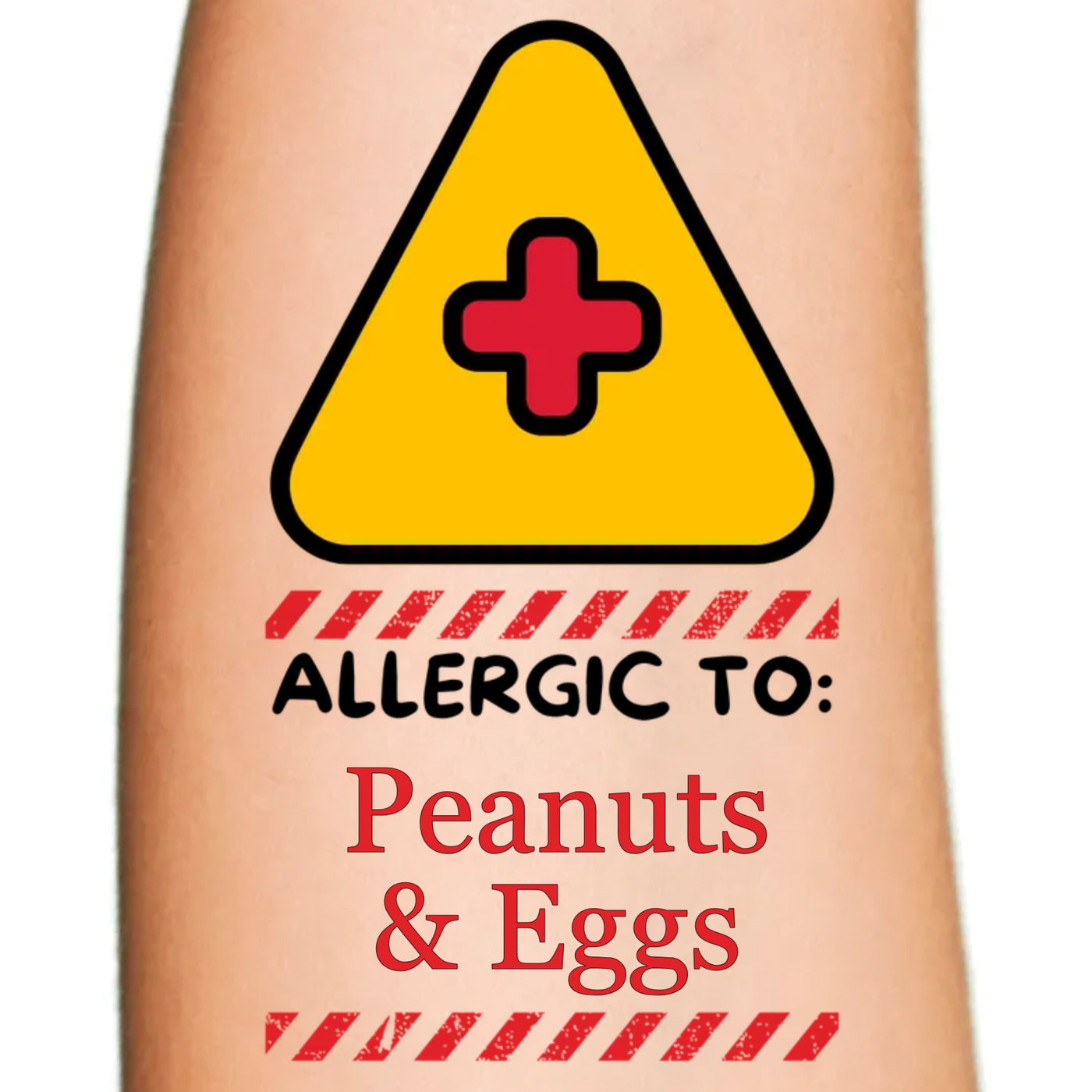 Allergy Warning